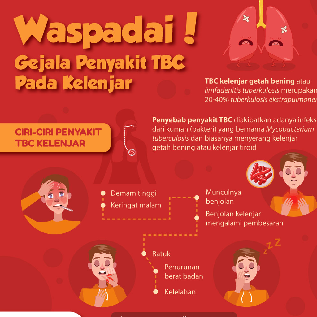 Daftar Ciri Ciri Penyakit TBC 2024 Wajib Di Perhatikan