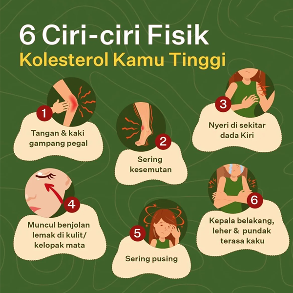 Daftar Ciri Ciri Kolesterol Tinggi Terbaru 2024